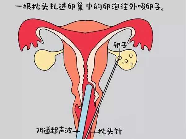 未指定试管公司如何选择？资深顾问支招